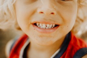 Child with a chipped tooth emergency dentist in Boise